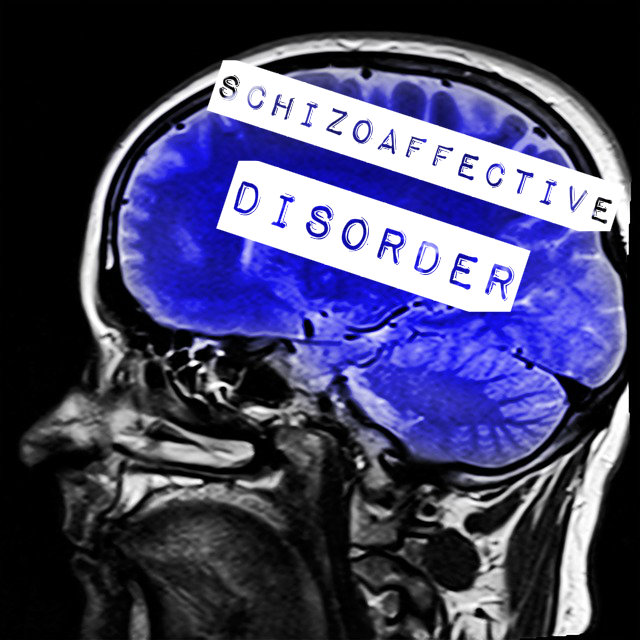 schizoaffective disorder video