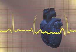 diagnosis and treatment of sick sinus syndrome diagnosis and treatment of sick sinus syndrome