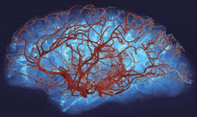 Small vessel disease