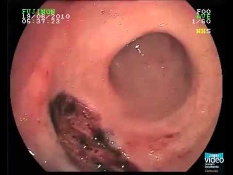 Naked anal reconstructive surgury porno