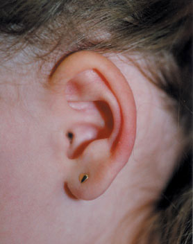What To Do For Dog Ear Ache What To Do For Dog Ear Ache