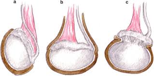 Steroid transformation ppt