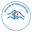 Journal of Osteoarthritis
